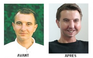 Besancekenottes
